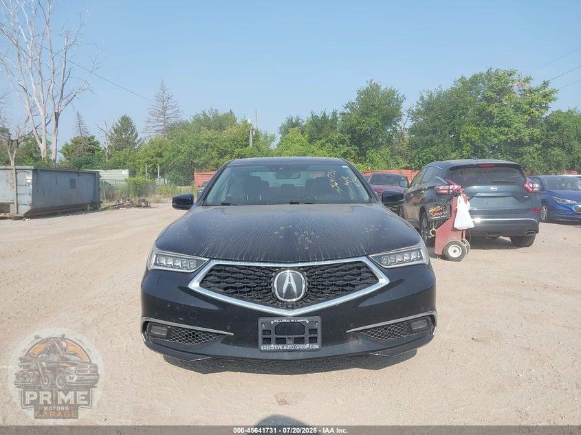 2018 ACURA TLX ADVANCE PKG — фото 12