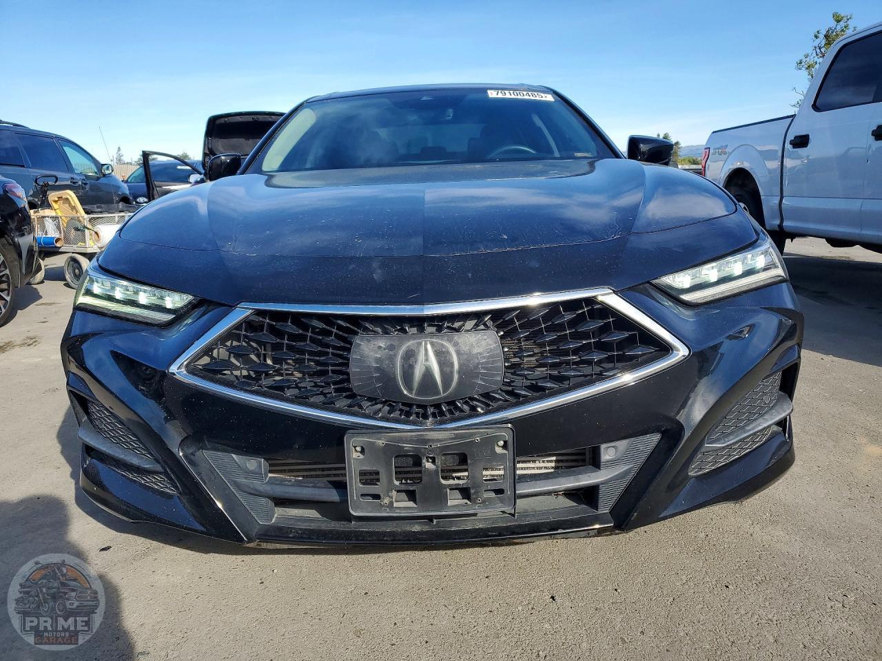2021 ACURA TLX — фото 5