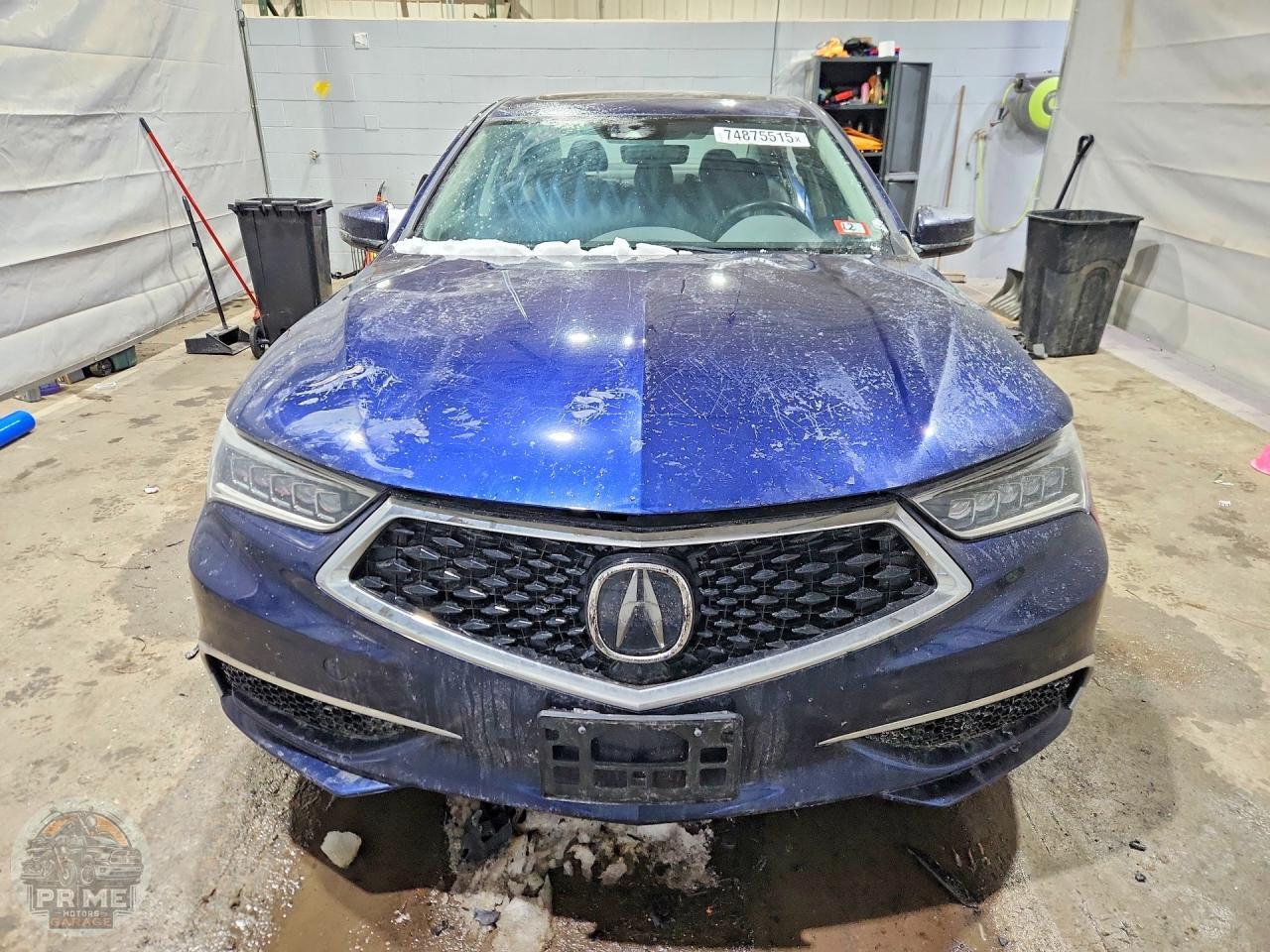 2020 ACURA TLX — фото 5