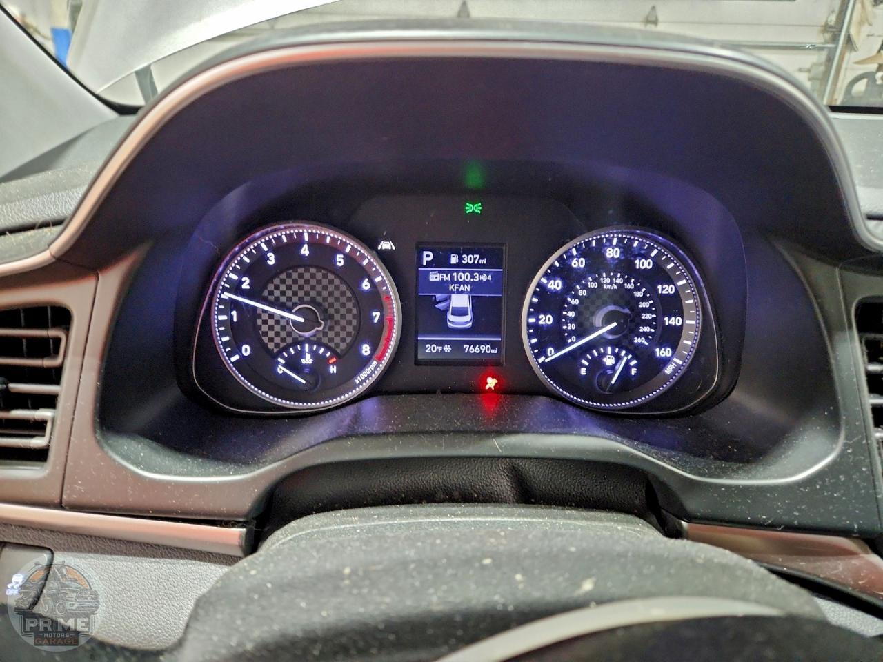 2020 HYUNDAI ELANTRA — фото 35