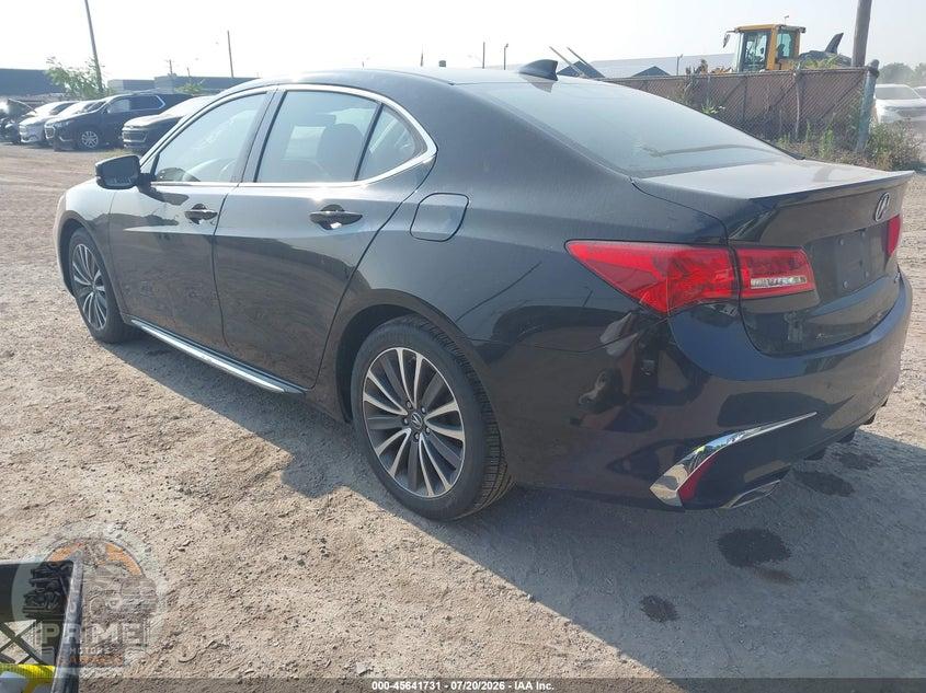 2018 ACURA TLX ADVANCE PKG — фото 3